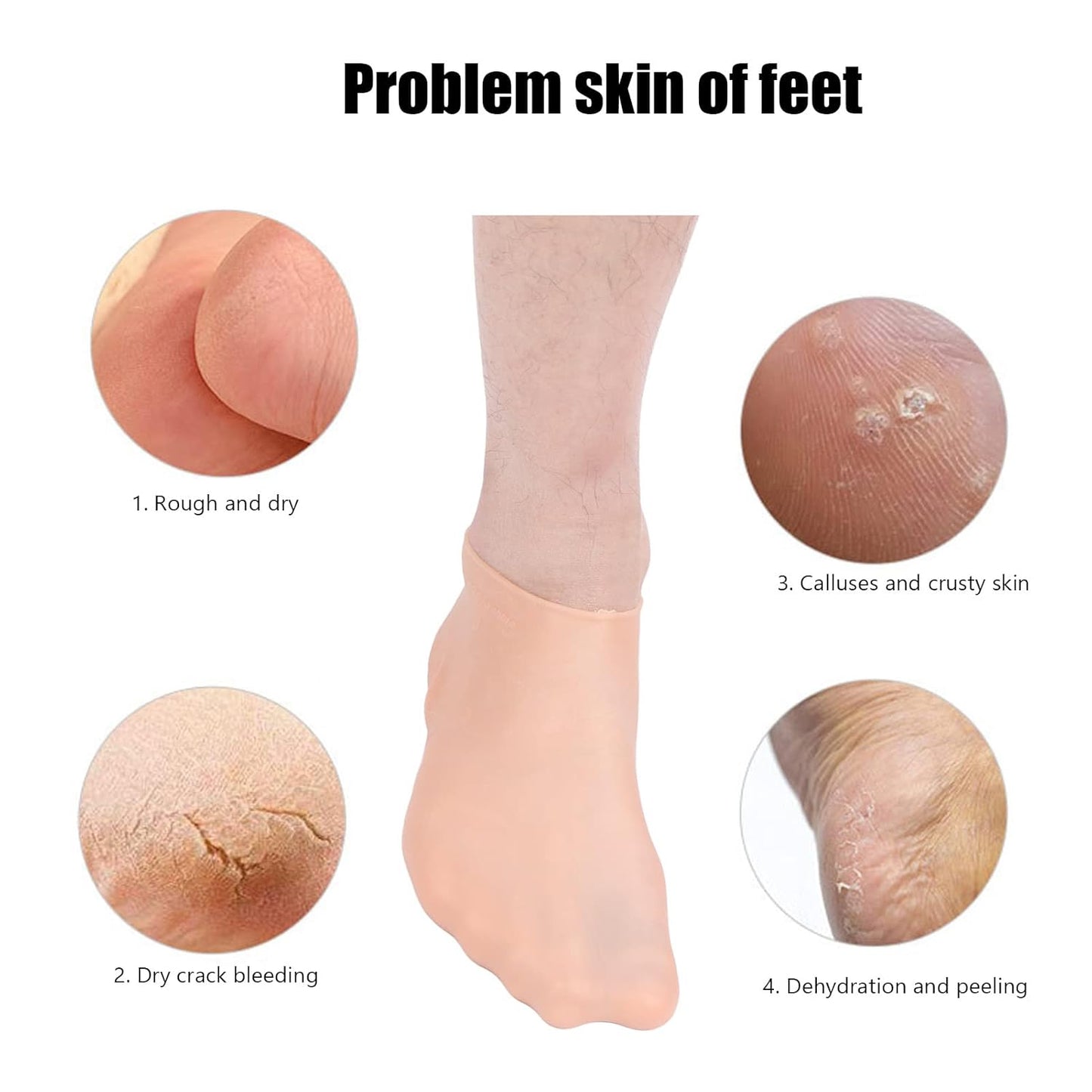 Silicone Moisturizing Socks – Softens & Repairs Dry Cracked Feet