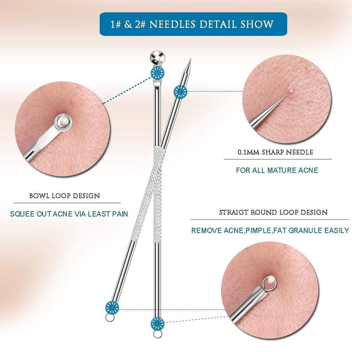 Blackhead Remover Tool – 4-in-1 Stainless Steel Extractor