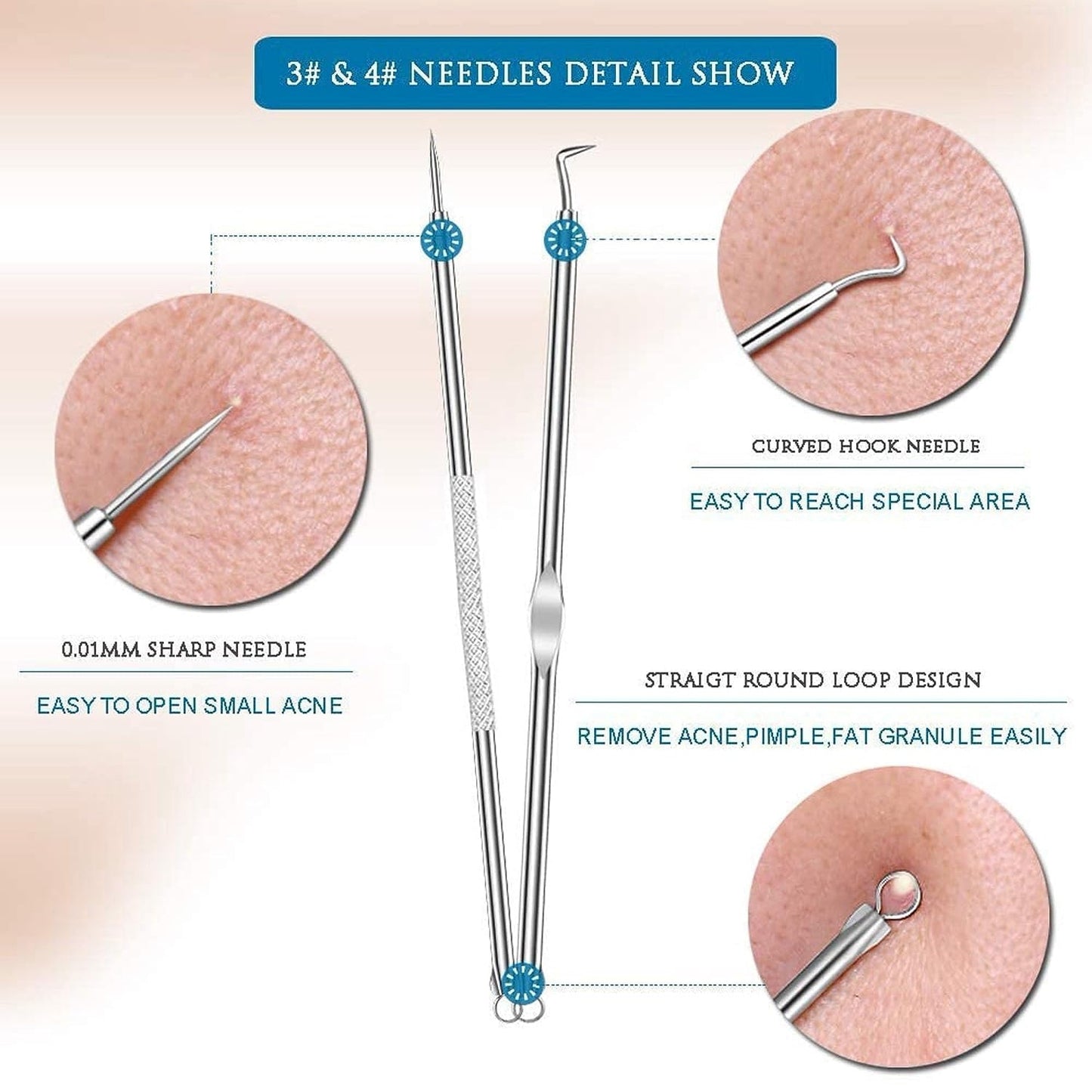 Blackhead Remover Tool – 4-in-1 Stainless Steel Extractor | ToolMate Pro