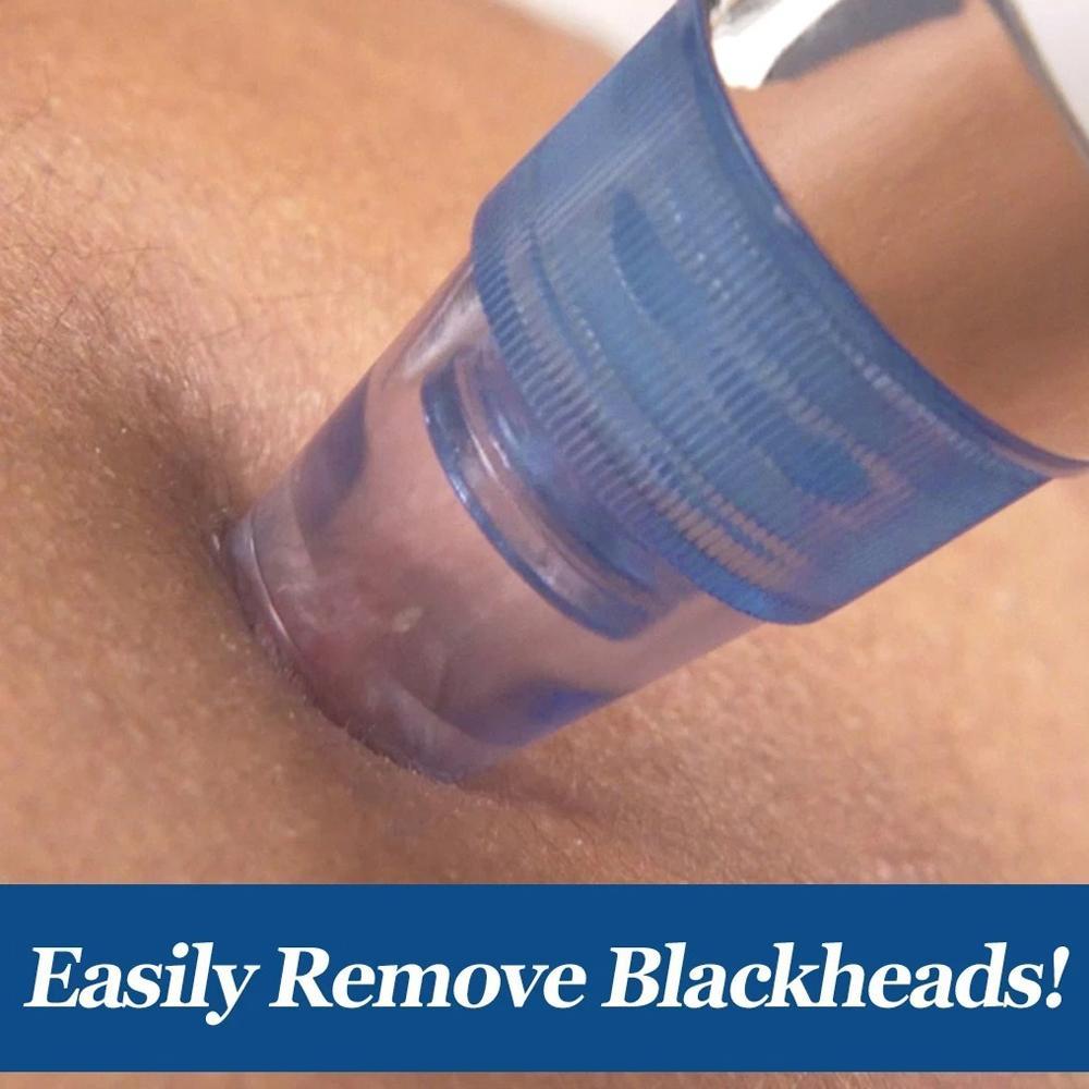 Blackhead Remover – 4-in-1 Vacuum Suction Pore Cleaner | ToolMate Pro