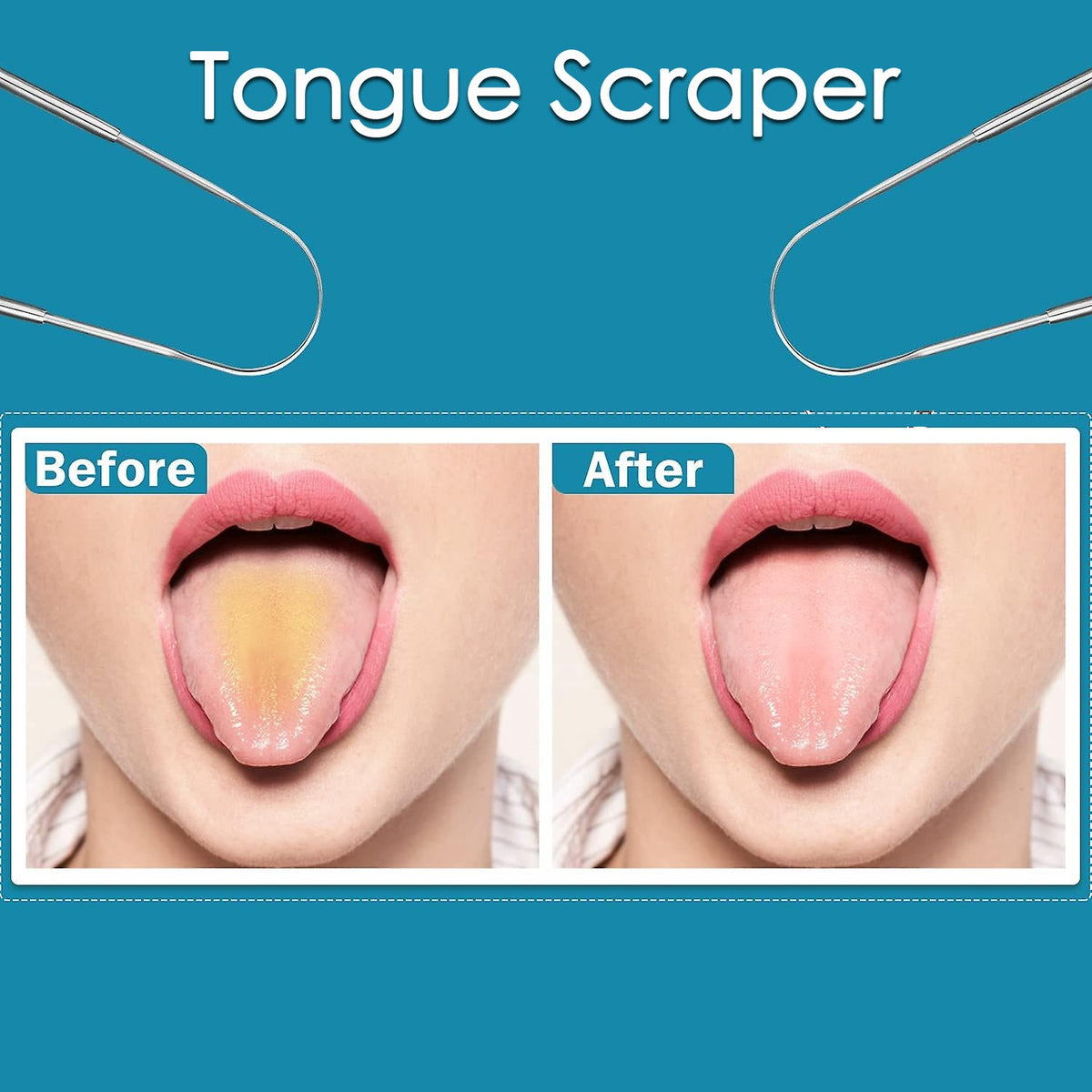 Tongue Cleaner – Fresh Breath & Oral Hygiene for All