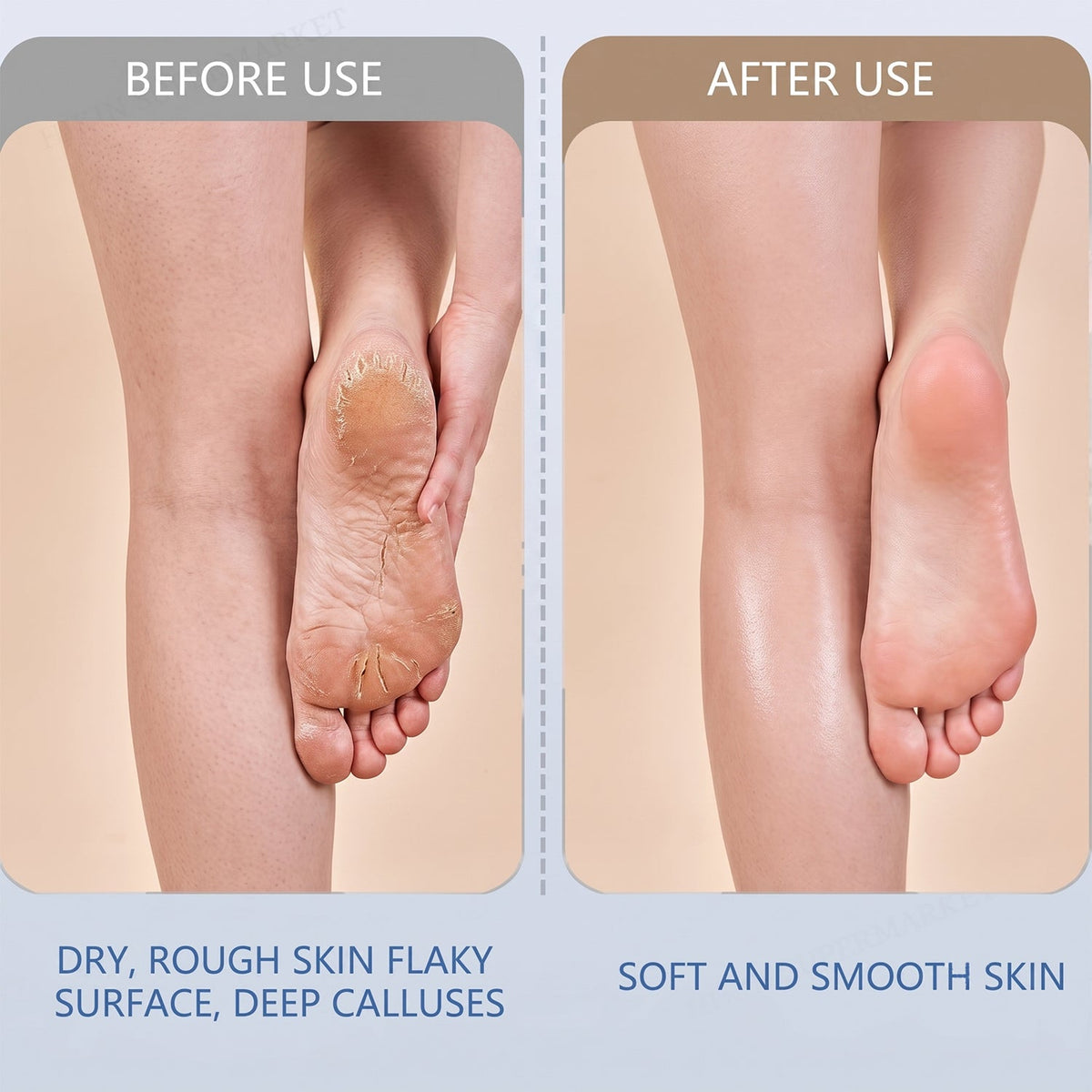 Electric Foot File – Rechargeable Callus Remover